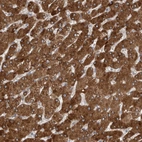Immunohistochemical staining of human liver shows strong cytoplasmic positivity in hepatocytes.