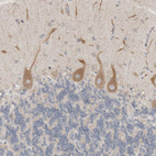 Immunohistochemical staining of human cerebellum shows moderate cytoplasmic positivity in Purkinje cells.