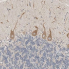 Immunohistochemical staining of human cerebellum shows moderate cytoplasmic positivity in Purkinje cells.