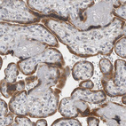 Immunohistochemical staining of human placenta shows strong cytoplasmic positivity in trophoblastic cells.
