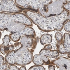 Immunohistochemical staining of human placenta shows strong cytoplasmic positivity in trophoblastic cells.