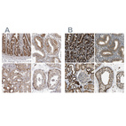 Anti-TUFM Antibody