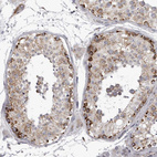 Immunohistochemical staining of human testis shows moderate to strong granular cytoplasmic positivity in cells in seminiferous ducts.