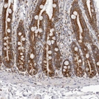 Immunohistochemical staining of human duodenum shows strong granular cytoplasmic positivity in glandular cells.