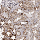 Immunohistochemical staining of human kidney shows moderate to strong granular cytoplasmic positivity in cells in tubules.