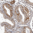 Immunohistochemical staining of human endometrium shows moderate granular cytoplasmic positivity in glandular cells.