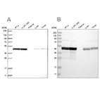 Western blot analysis using Anti-TUFM antibody HPA024087 (A) shows similar pattern to independent antibody HPA018991 (B).