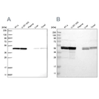 Western blot analysis using Anti-TUFM antibody HPA024087 (A) shows similar pattern to independent antibody HPA018991 (B).