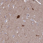 Anti-CEP41 Antibody