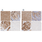 Immunohistochemical staining of human cerebral cortex, duodenum, kidney and skeletal muscle using Anti-GDA antibody HPA024099 (A) shows similar protein distribution across tissues to independent antibody HPA030387 (B).