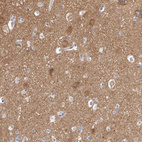 Immunohistochemical staining of human cerebral cortex shows moderate cytoplasmic positivity in neurons.