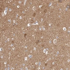 Immunohistochemical staining of human cerebral cortex shows moderate cytoplasmic positivity in neurons.