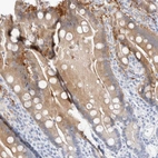 Immunohistochemical staining of human duodenum shows weak cytoplasmic positivity in glandular cells.