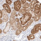 Immunohistochemical staining of human kidney shows moderate cytoplasmic positivity in cells in tubules.