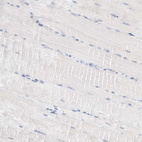 Immunohistochemical staining of human skeletal muscle shows no positivity in myocytes as expected.