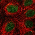 Immunofluorescent staining of human cell line A-431 shows localization to nucleus.