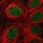Immunofluorescent staining of human cell line A-431 shows localization to nucleus.