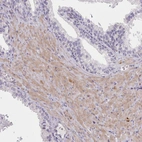 Immunohistochemical staining of human prostate shows moderate cytoplasmic positivity in smooth muscle cells.