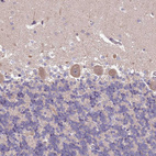 Immunohistochemical staining of human cerebellum shows weak cytoplasmic positivity in Purkinje cells.