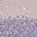 Immunohistochemical staining of human cerebellum shows weak cytoplasmic positivity in Purkinje cells.