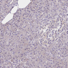 Immunohistochemical staining of human pancreas shows no positivity in exocrine glandular cells as expected.