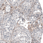 Immunohistochemical staining of human testis shows moderate cytoplasmic positivity in Leydig cells.