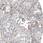 Immunohistochemical staining of human testis shows moderate cytoplasmic positivity in Leydig cells.