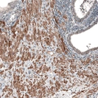 Immunohistochemical staining of human prostate shows moderate to strong membranous and cytoplasmic positivity in smooth muscle cells.