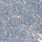 Immunohistochemical staining of human lymph node shows low positivity in non-germinal center cells as expected.