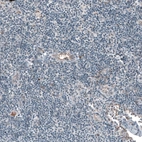 Immunohistochemical staining of human lymph node shows low positivity in non-germinal center cells as expected.