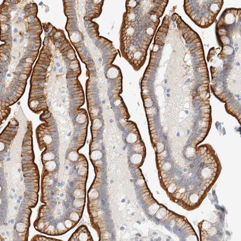 Anti-C1QTNF12 Antibody