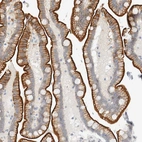 Anti-C1QTNF12 Antibody