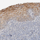 Immunohistochemical staining of human Tonsil shows moderate membranous and cytoplasmic positivity in squamous epithelial cells.