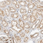 Immunohistochemical staining of human Kidney shows moderate membranous and cytoplasmic positivity in cells in tubules.