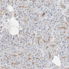 Immunohistochemical staining of human Pancreas shows moderate membranous positivity in exocrine glandular cells.