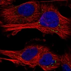 Immunofluorescent staining of human cell line U-251 MG shows localization to vesicles.
