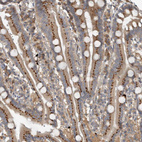 Anti-CLCN2 Antibody