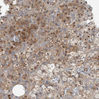 Anti-CLCN2 Antibody