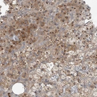 Immunohistochemical staining of human adrenal gland shows moderate granular cytoplasmic positivity in glandular cells.