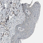 Immunohistochemical staining of human skin shows very weak positivity in squamous epithelial cells as expected.