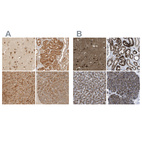 Anti-TMEM192 Antibody