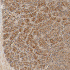 Anti-TMEM192 Antibody