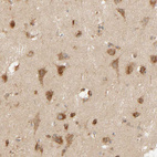 Immunohistochemical staining of human cerebral cortex shows moderate to strong granular cytoplasmic positivity in neurons.