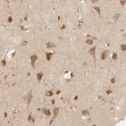 Immunohistochemical staining of human cerebral cortex shows moderate to strong granular cytoplasmic positivity in neurons.