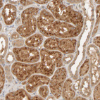 Immunohistochemical staining of human kidney shows moderate to strong granular cytoplasmic positivity in cells in tubules.