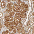 Anti-TMEM192 Antibody