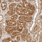 Immunohistochemical staining of human kidney shows moderate to strong granular cytoplasmic positivity in cells in tubules.