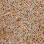 Anti-TMEM192 Antibody