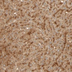 Immunohistochemical staining of human liver shows moderate to strong granular cytoplasmic positivity in hepatocytes.