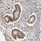 Anti-PUS7 Antibody